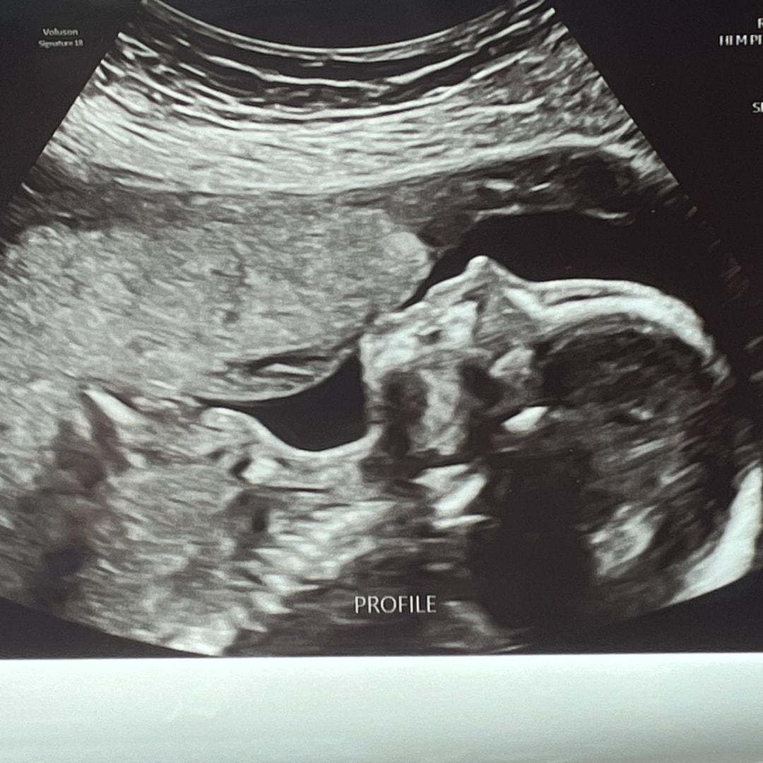 Photo shared by Valerie for their Babylist baby registry.