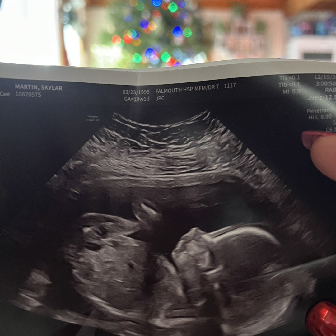 Photo shared by Skylar for their Babylist baby registry.