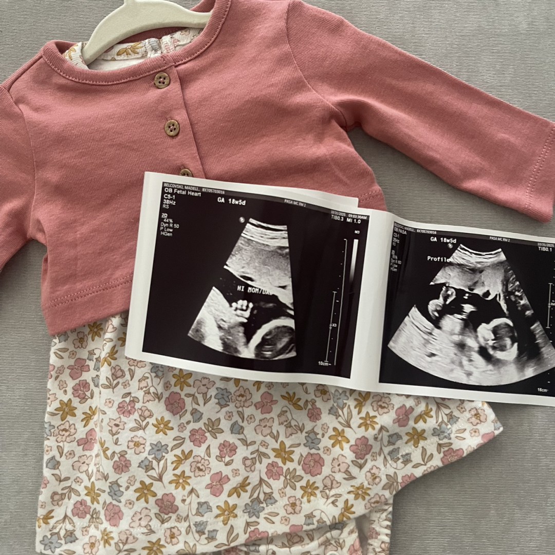 Photo shared by Madeline for their Babylist baby registry.