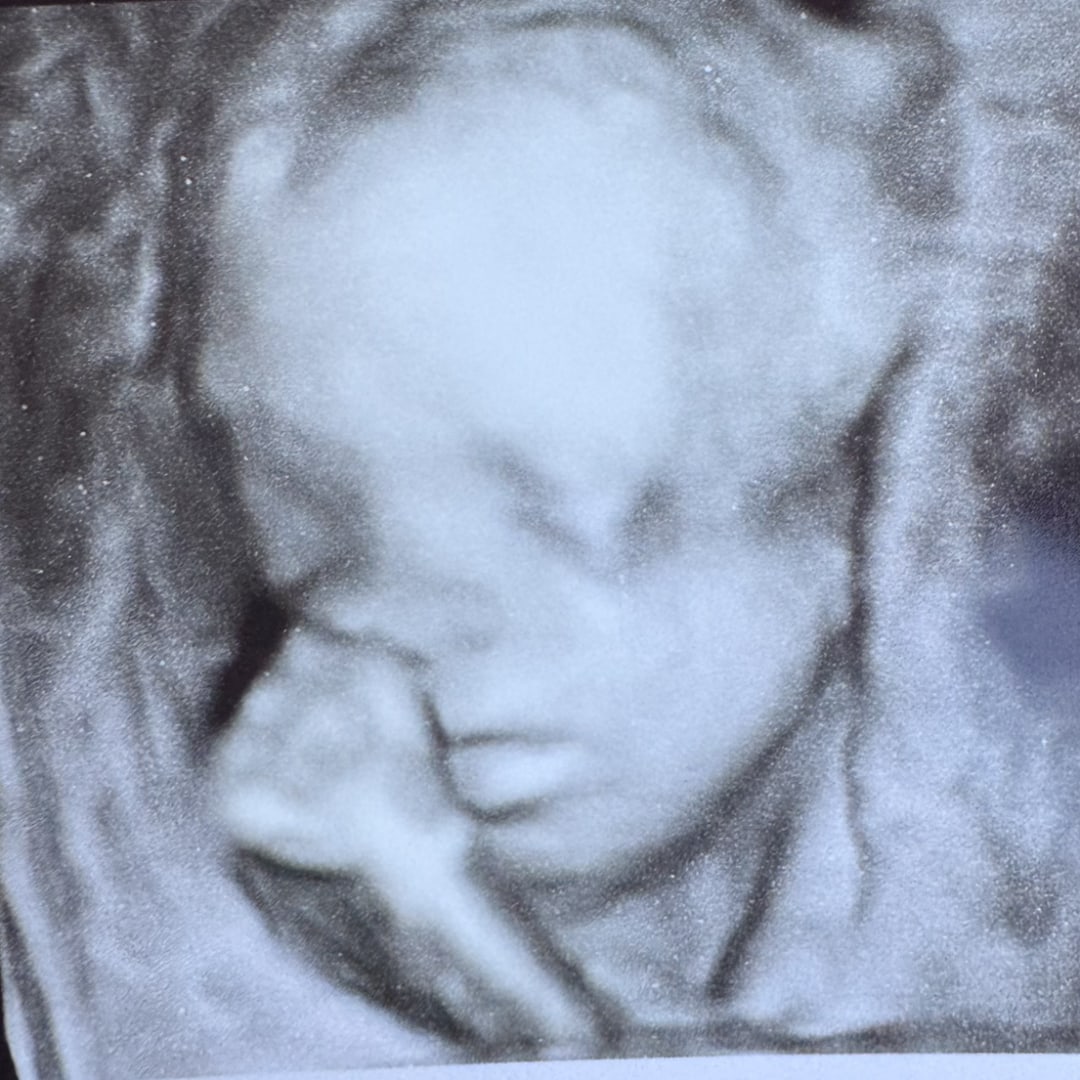 Photo shared by Cheyenne for their Babylist baby registry.