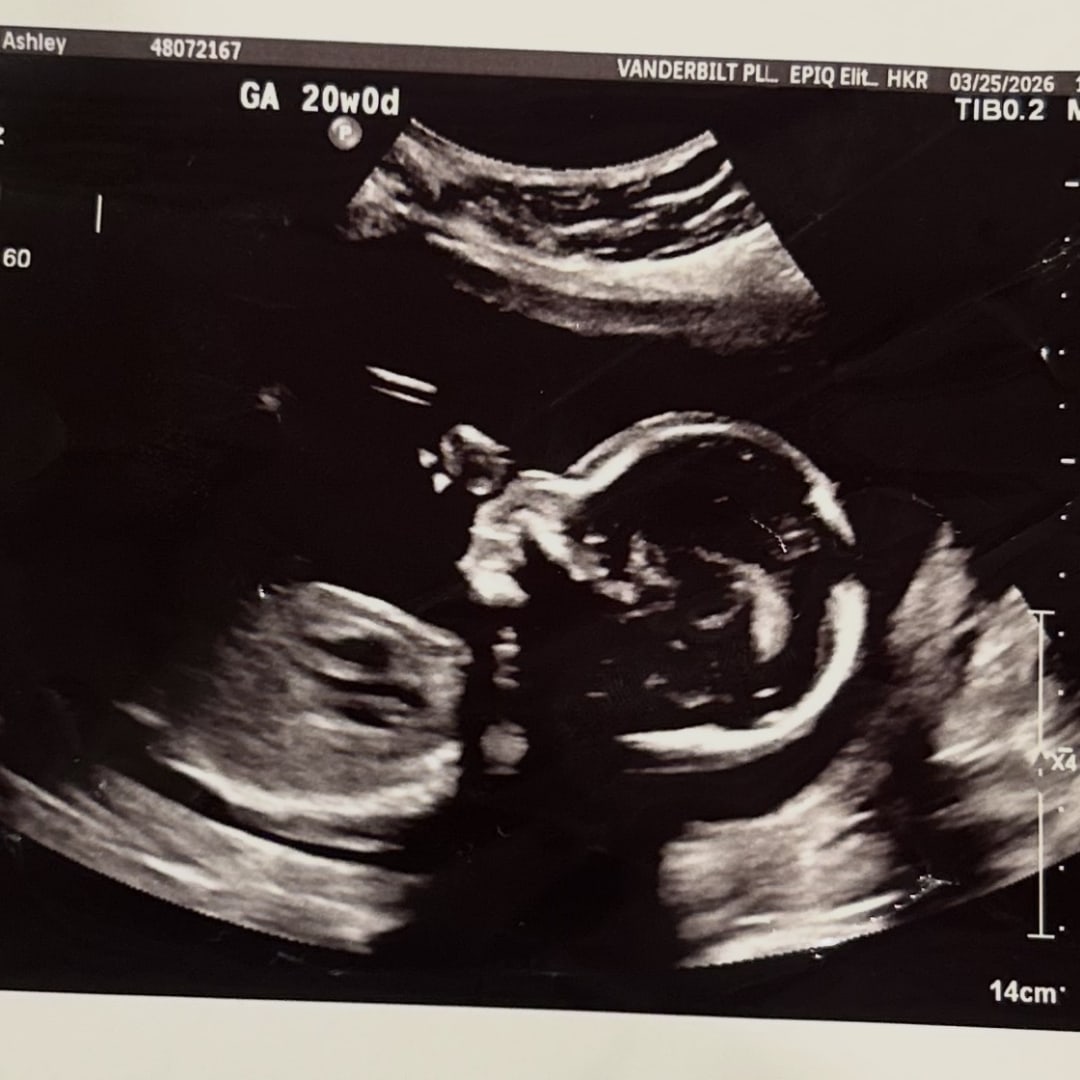 Photo shared by Ash for their Babylist baby registry.