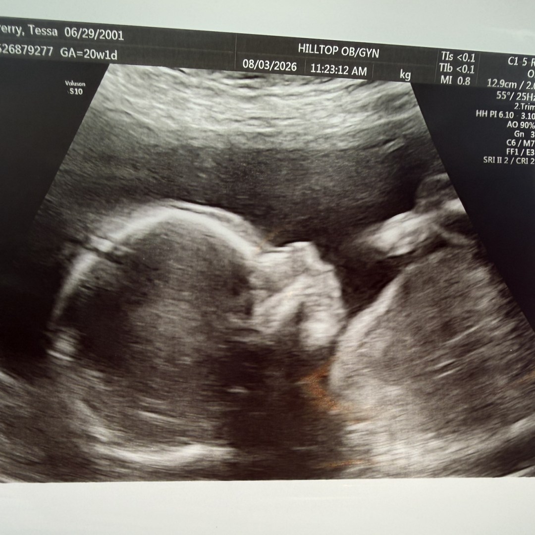 Photo shared by Tessa for their Babylist baby registry.
