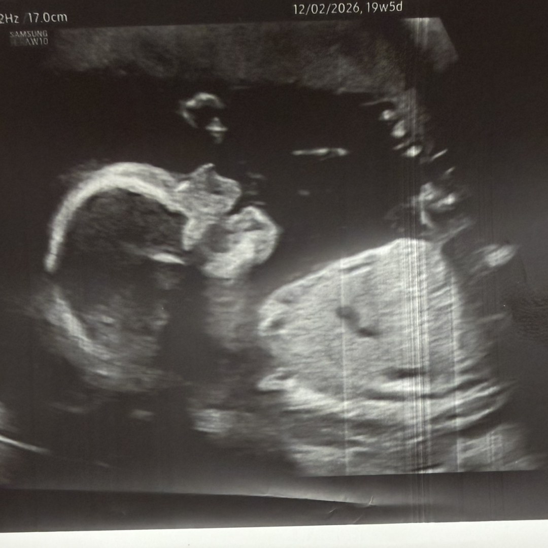 Photo shared by Paige for their Babylist baby registry.