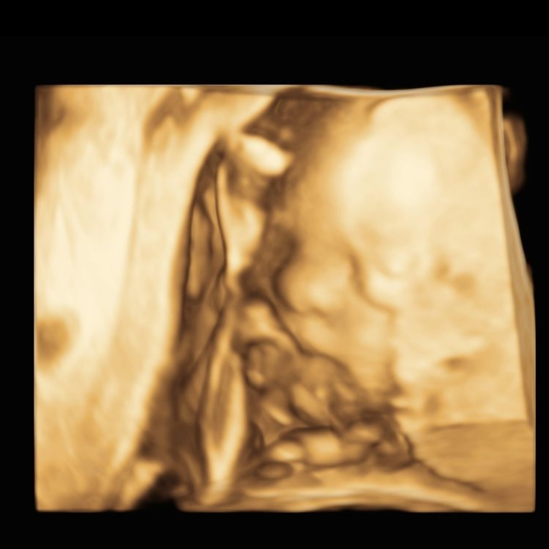 Photo shared by Abigail for their Babylist baby registry.