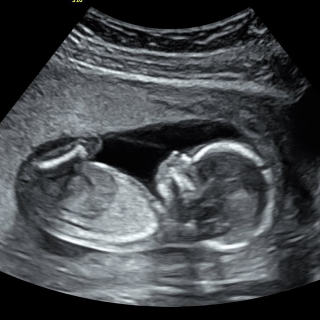 Photo shared by Julie for their Babylist baby registry.