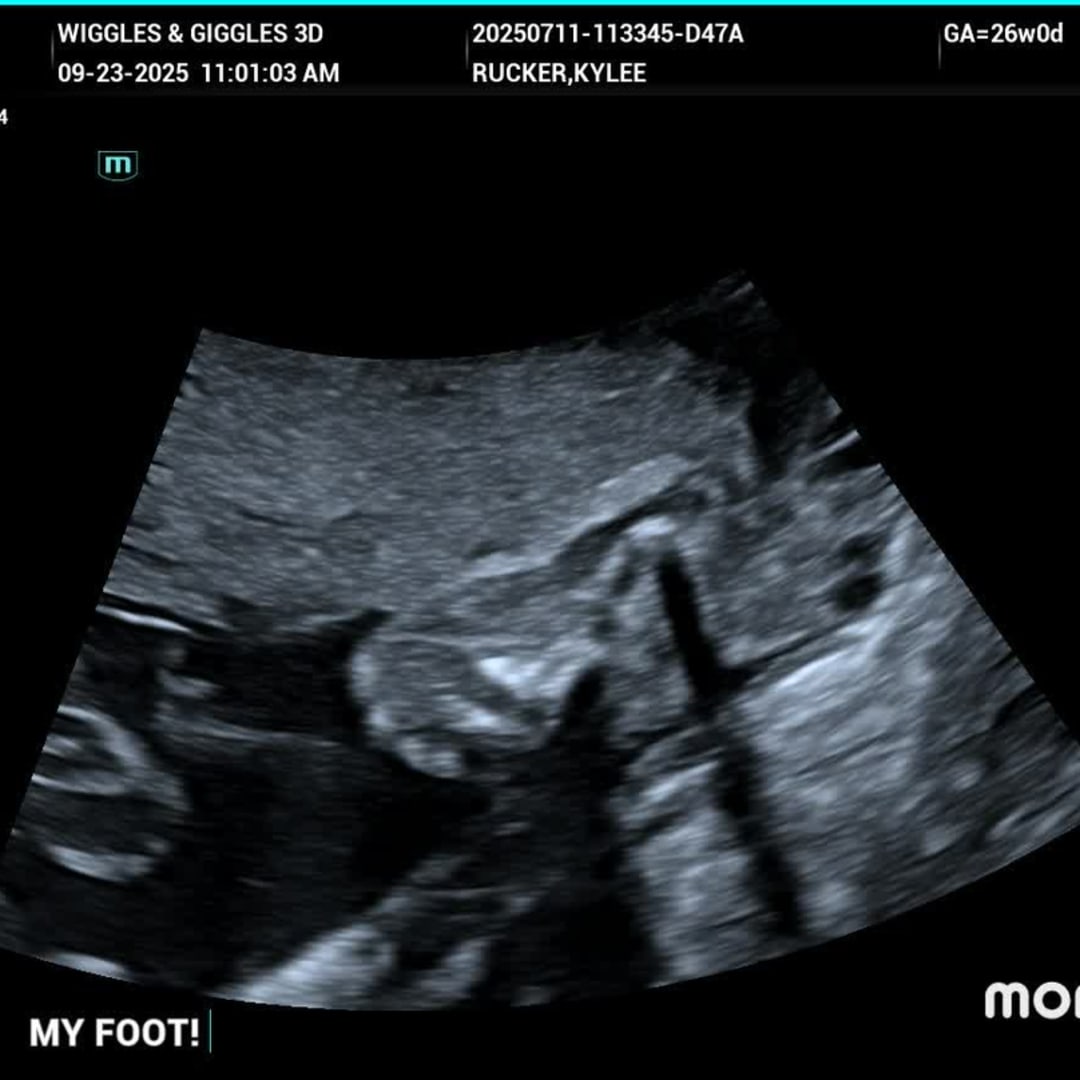 Photo shared by Kylee for their Babylist baby registry.