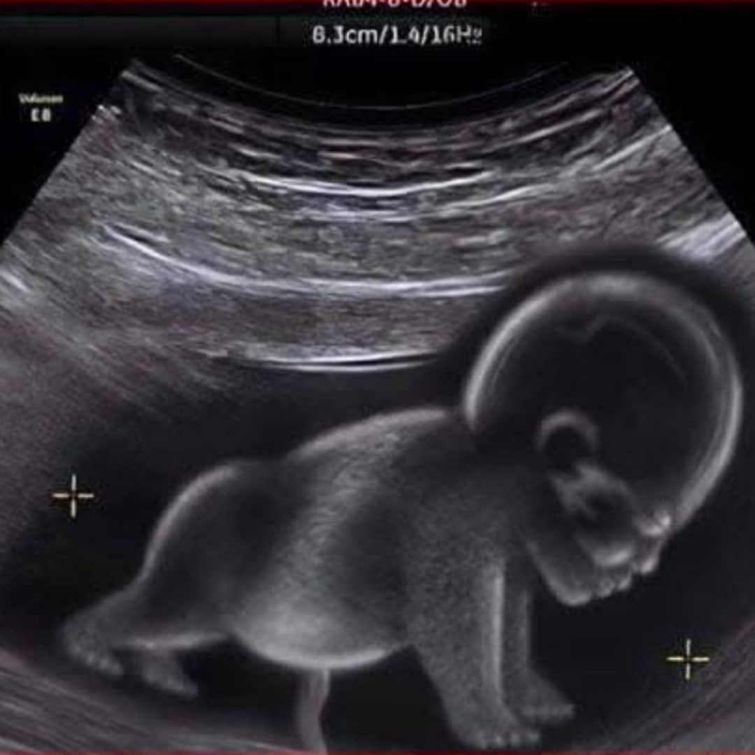 Photo shared by Miguel for their Babylist baby registry.