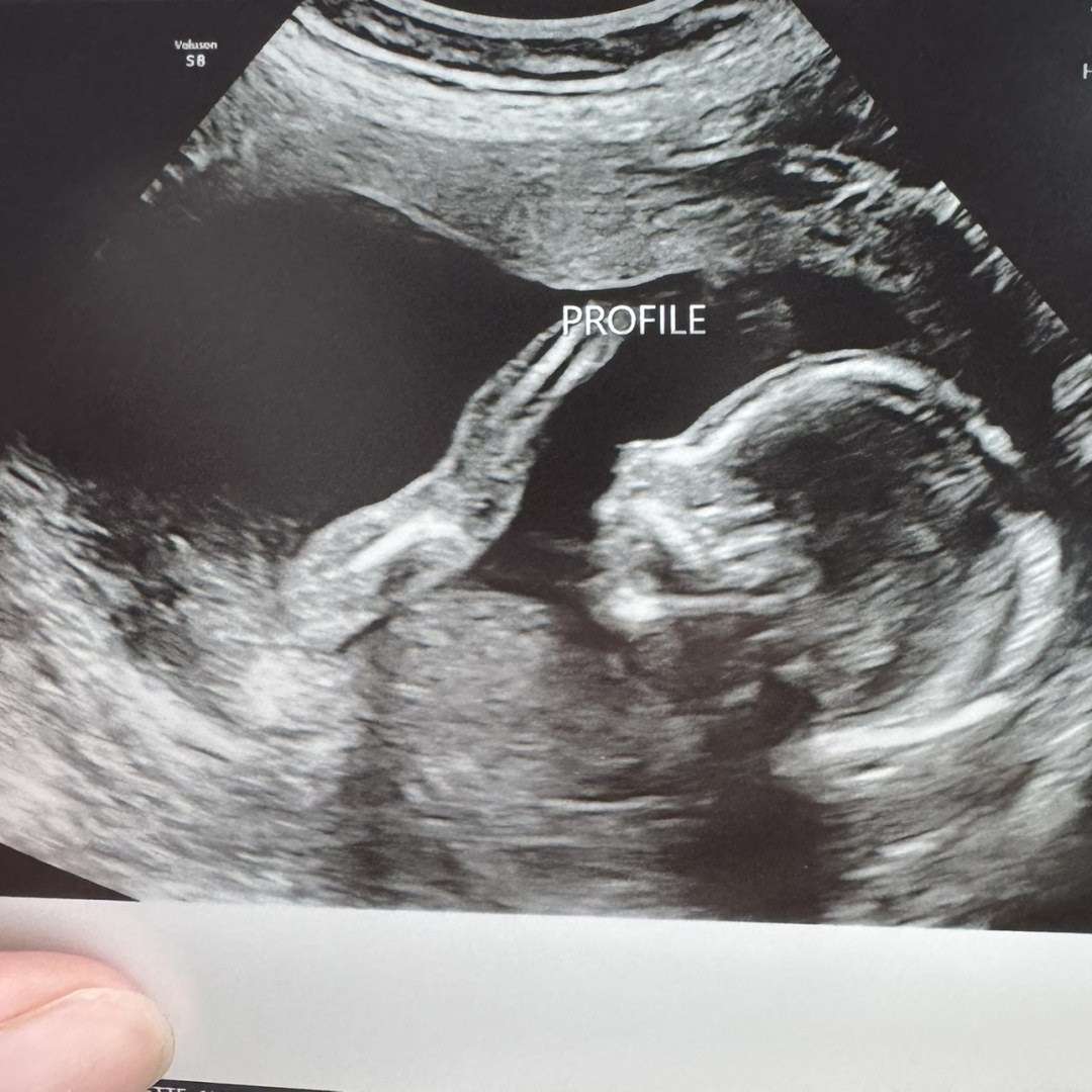 Photo shared by Nicolette for their Babylist baby registry.