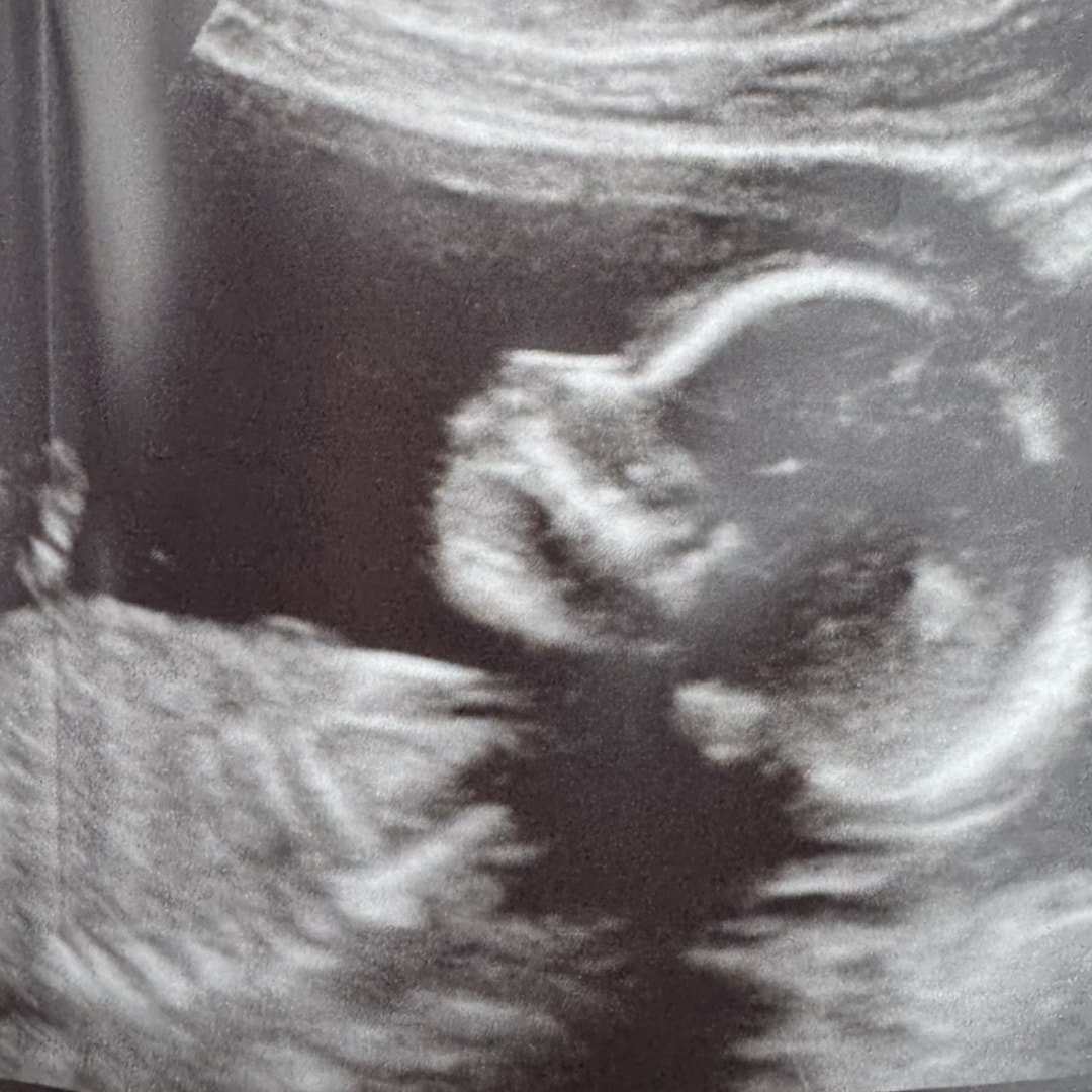 Photo shared by Cristina for their Babylist baby registry.