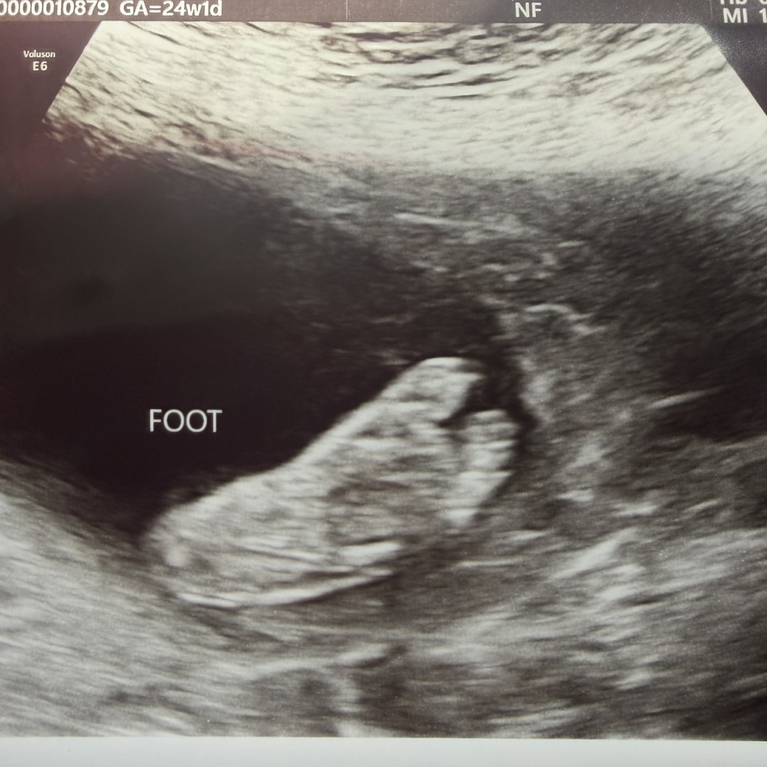 Photo shared by Inez for their Babylist baby registry.