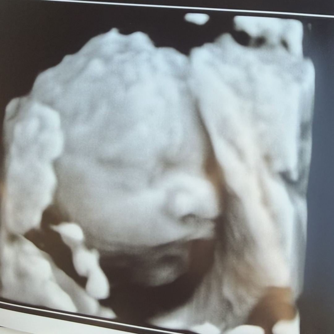 Photo shared by Briana for their Babylist baby registry.