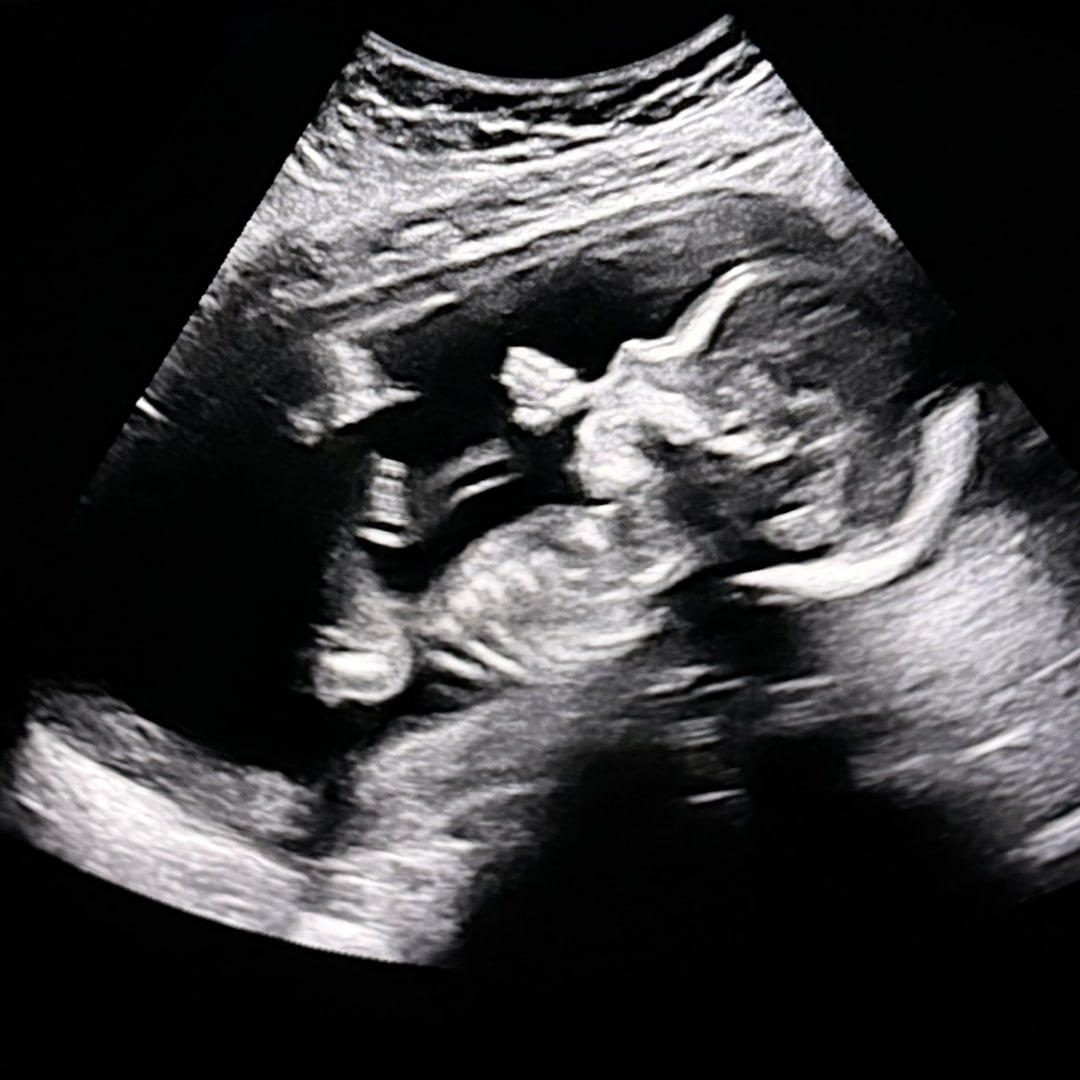 Photo shared by McKenzie for their Babylist baby registry.