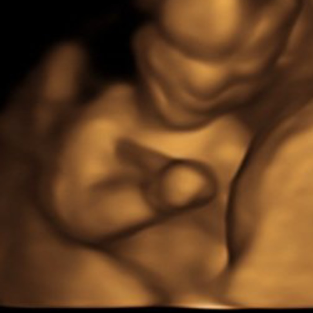 Photo shared by Erin for their Babylist baby registry.