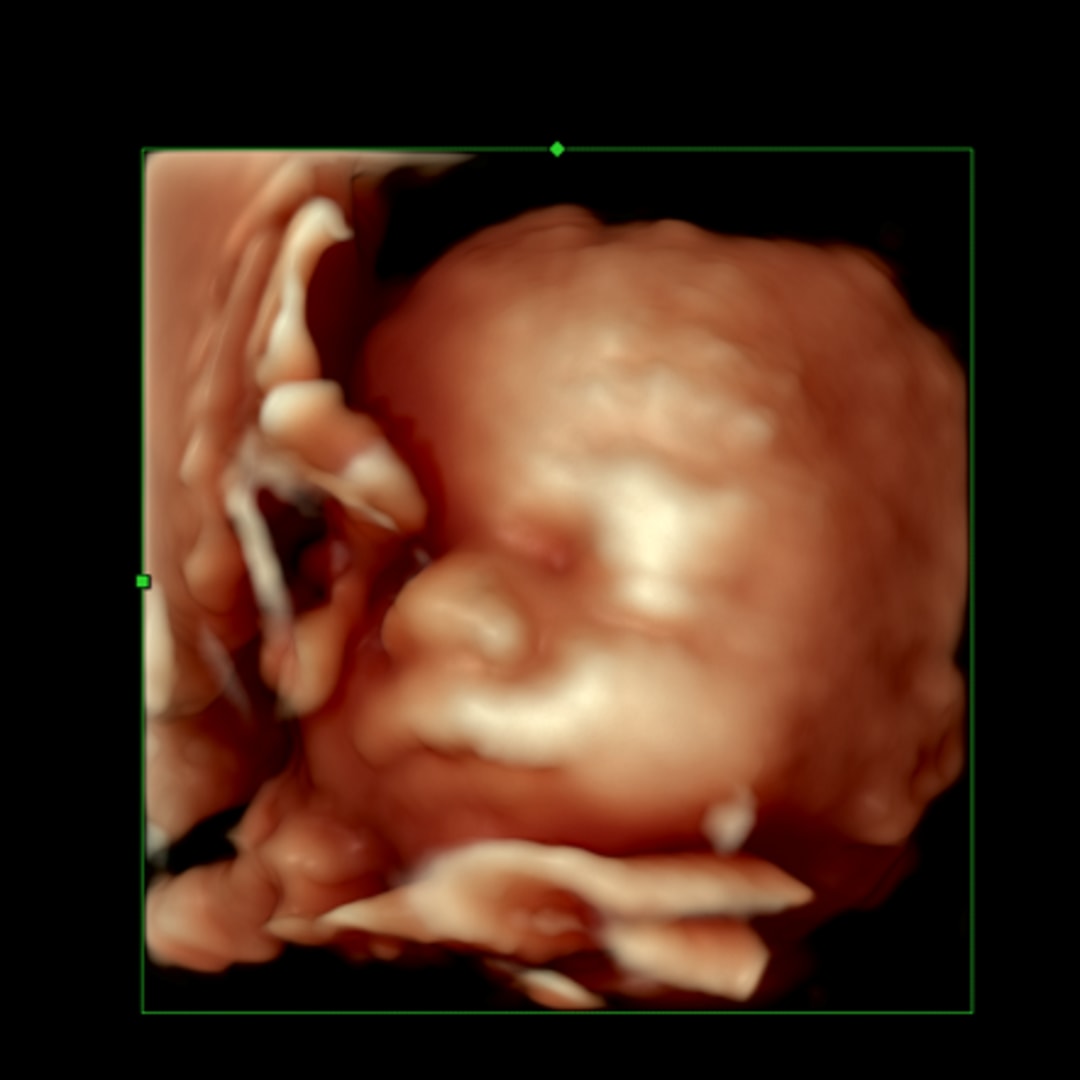 Photo shared by Allison for their Babylist baby registry.