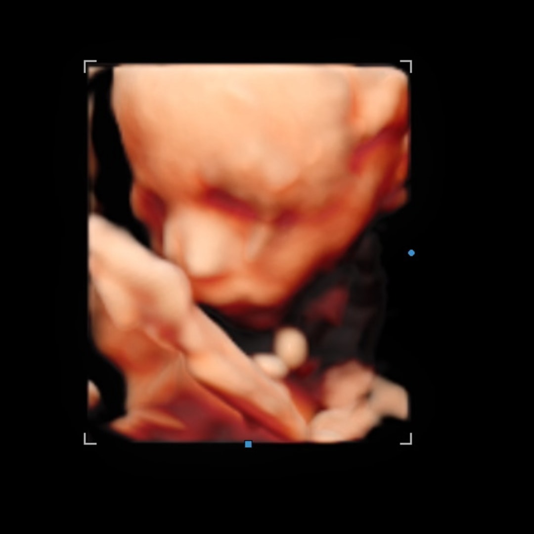 Photo shared by Caitlin for their Babylist baby registry.