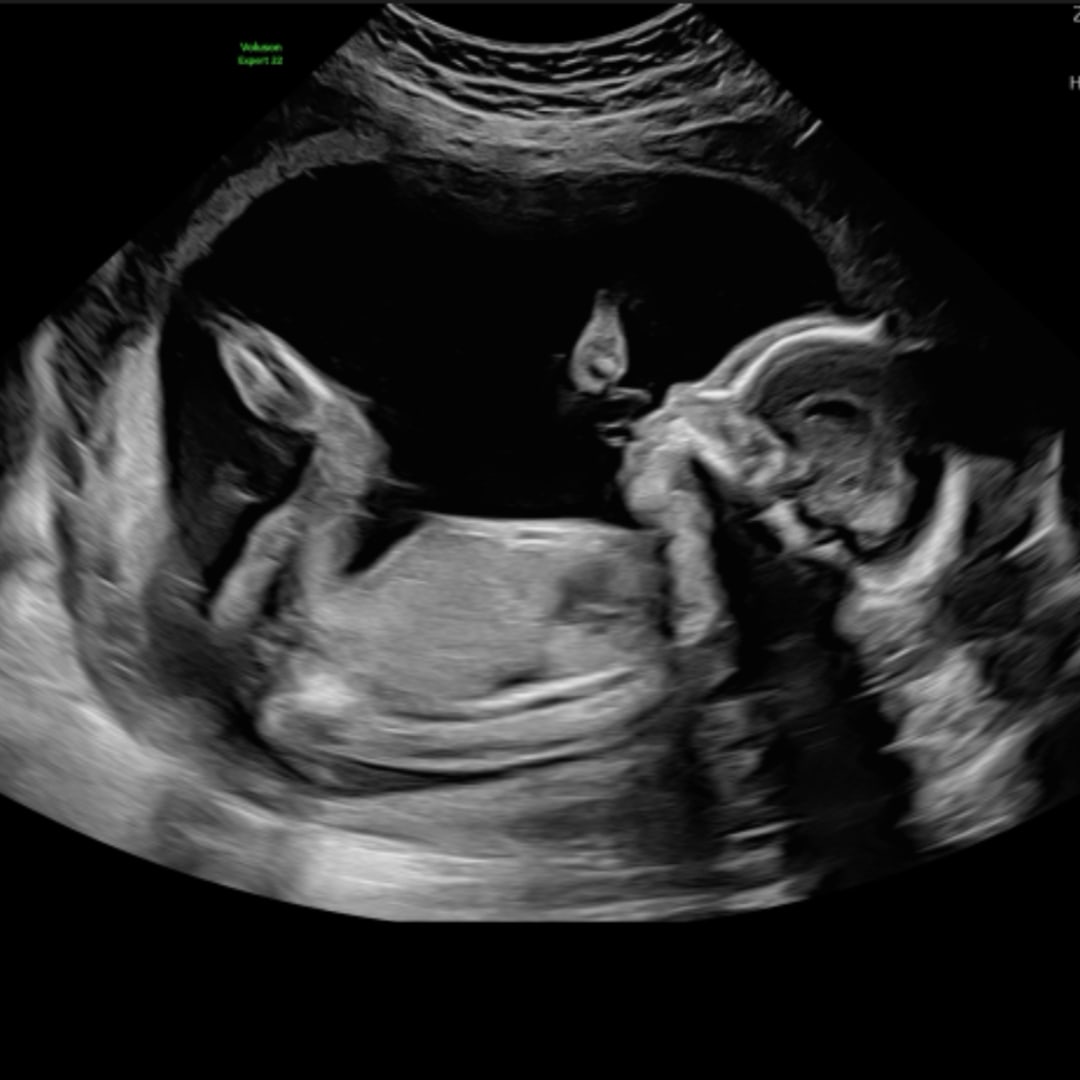 Photo shared by Christiano for their Babylist baby registry.