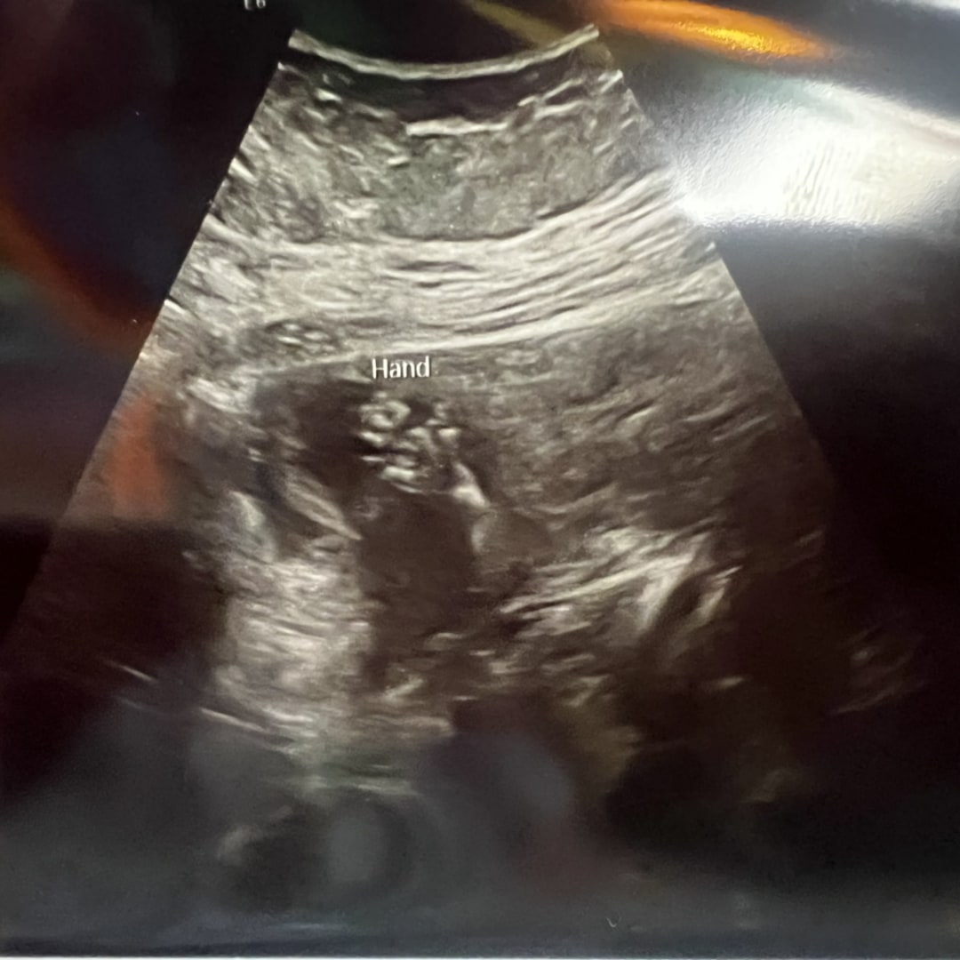 Photo shared by Brooke for their Babylist baby registry.