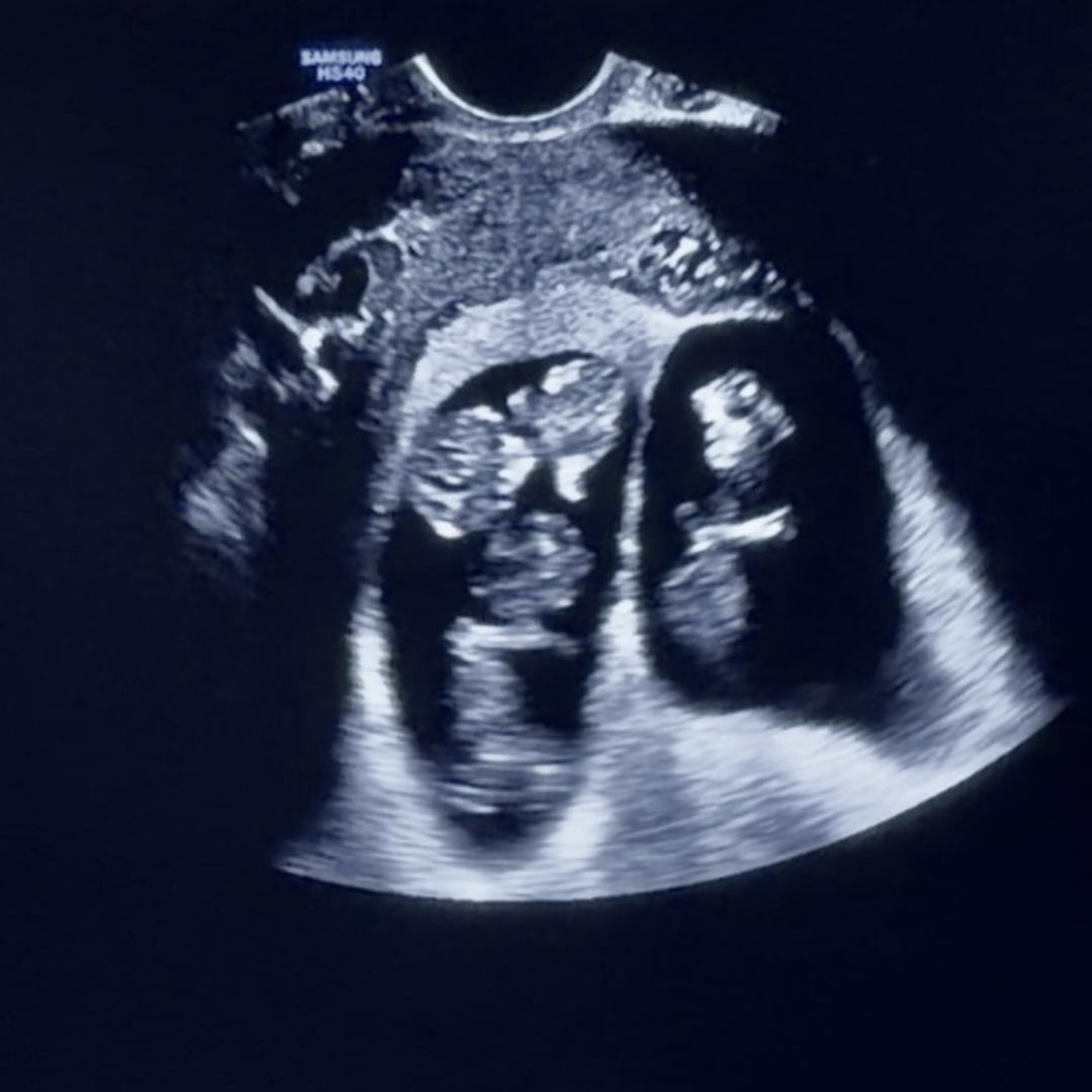 Photo shared by Heath & Pascal for their Babylist baby registry.