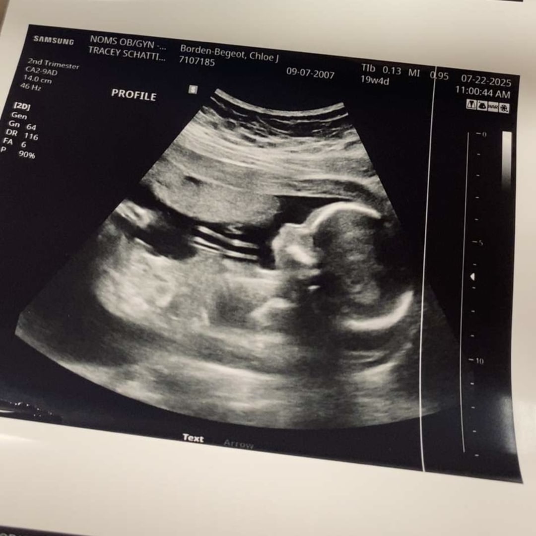 Photo shared by Chloe for their Babylist baby registry.