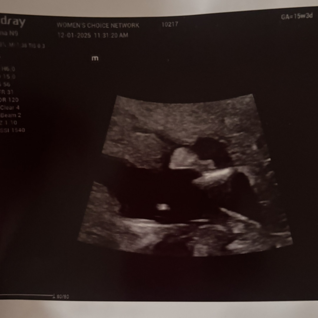 Photo shared by Jianna for their Babylist baby registry.