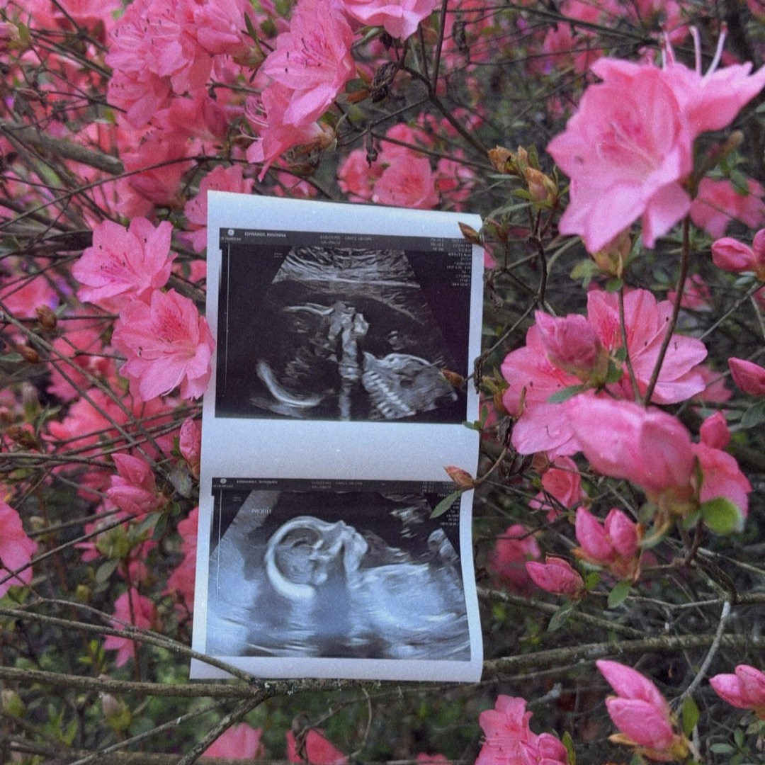 Photo shared by Rhionna for their Babylist baby registry.