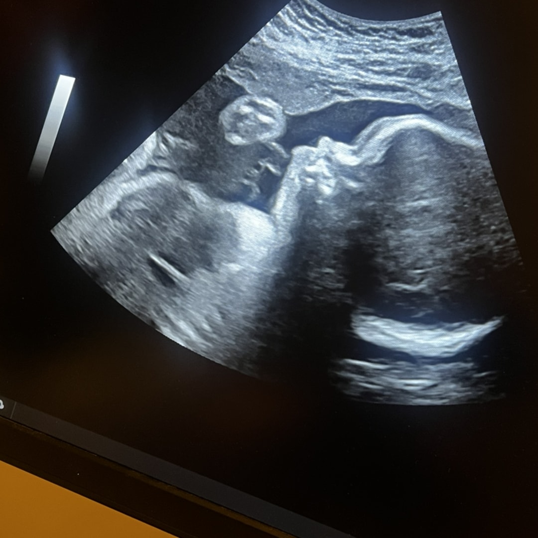 Photo shared by Cesaleigh for their Babylist baby registry.