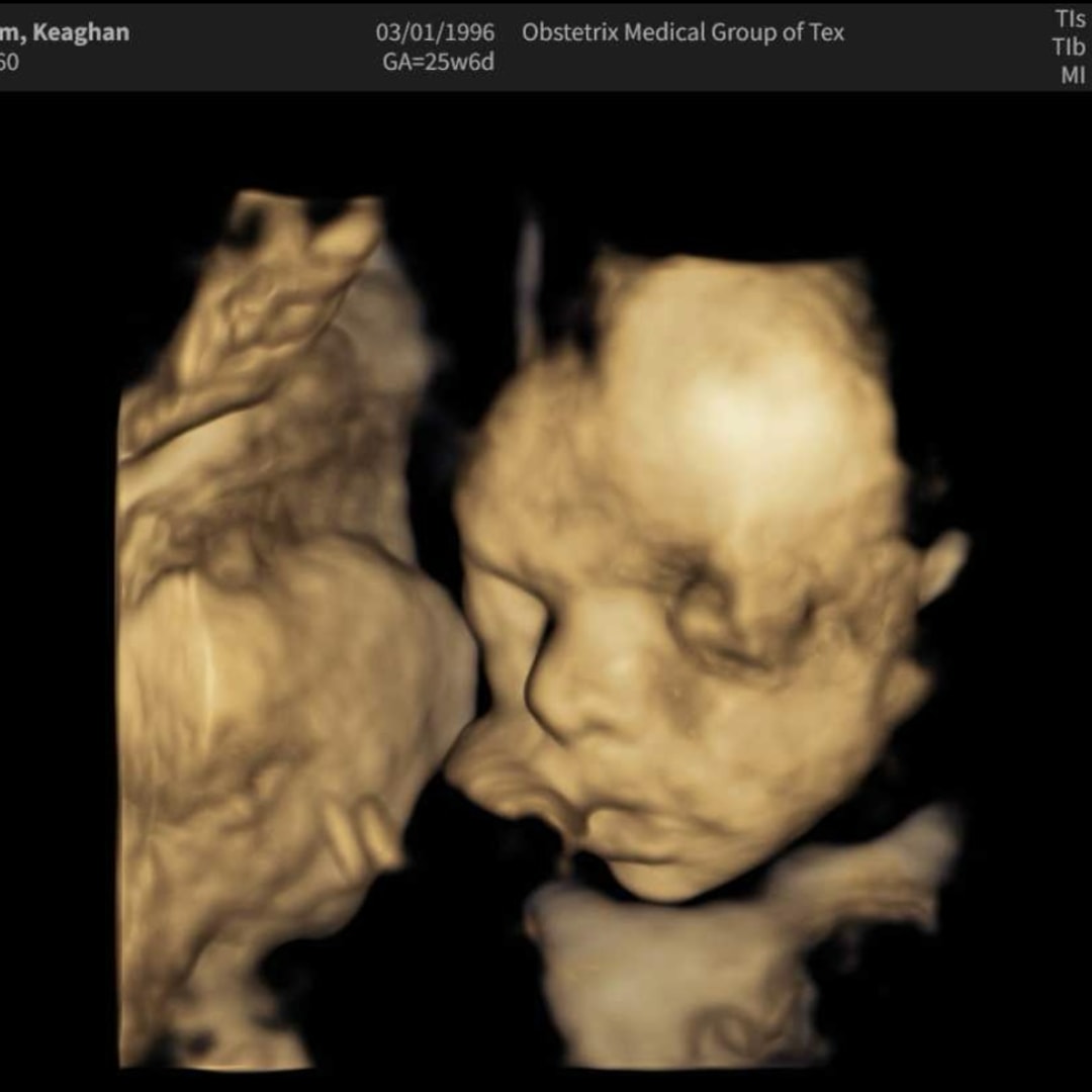 Photo shared by Keaghan for their Babylist baby registry.