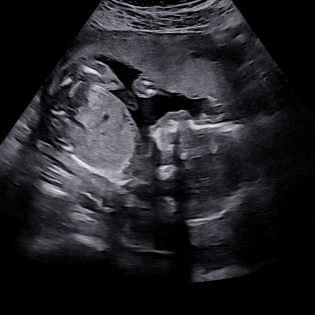 Photo shared by Allyson for their Babylist baby registry.