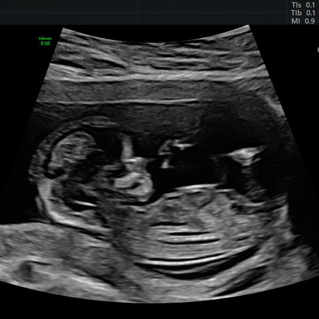 Photo shared by Yaromie for their Babylist baby registry.