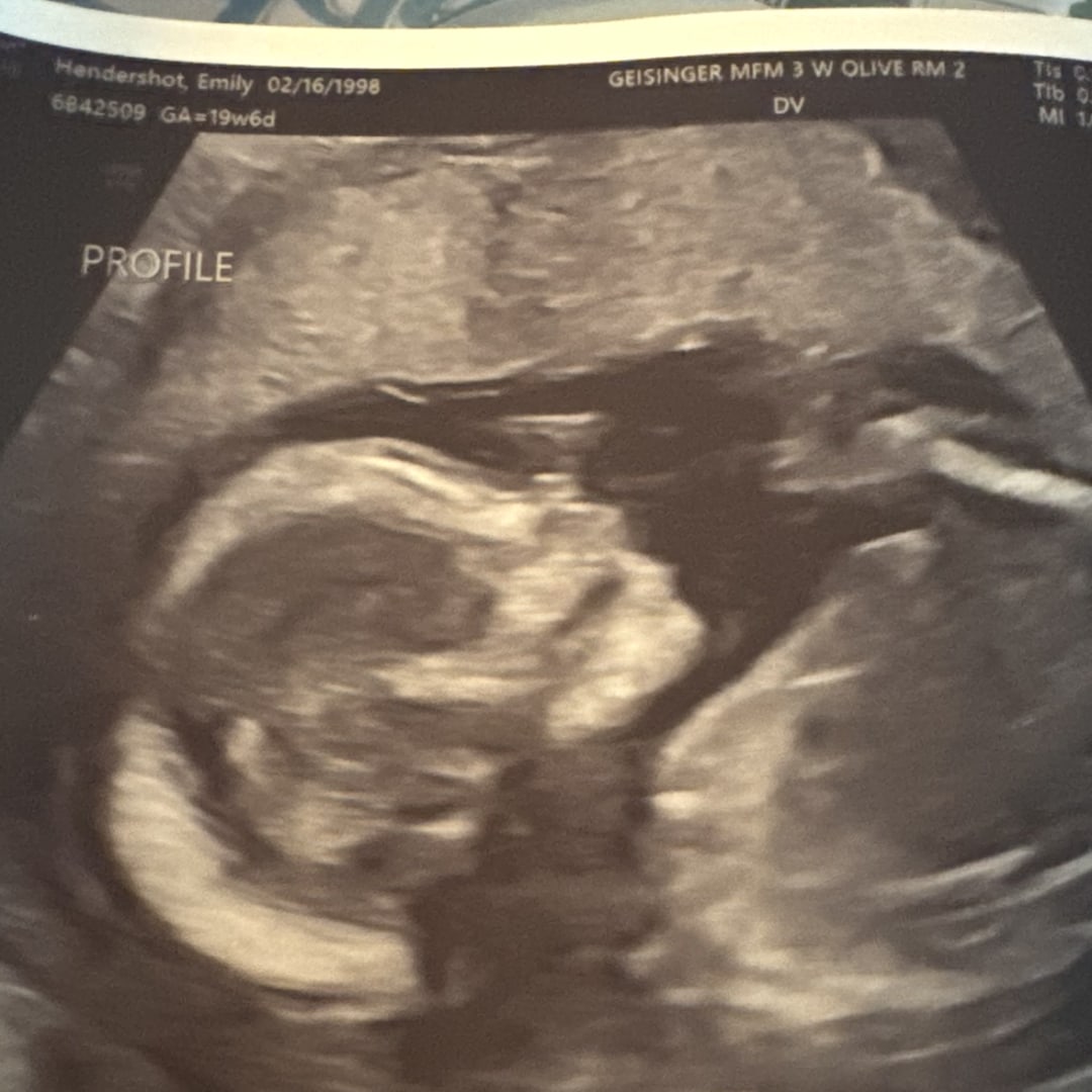 Photo shared by Emily for their Babylist baby registry.