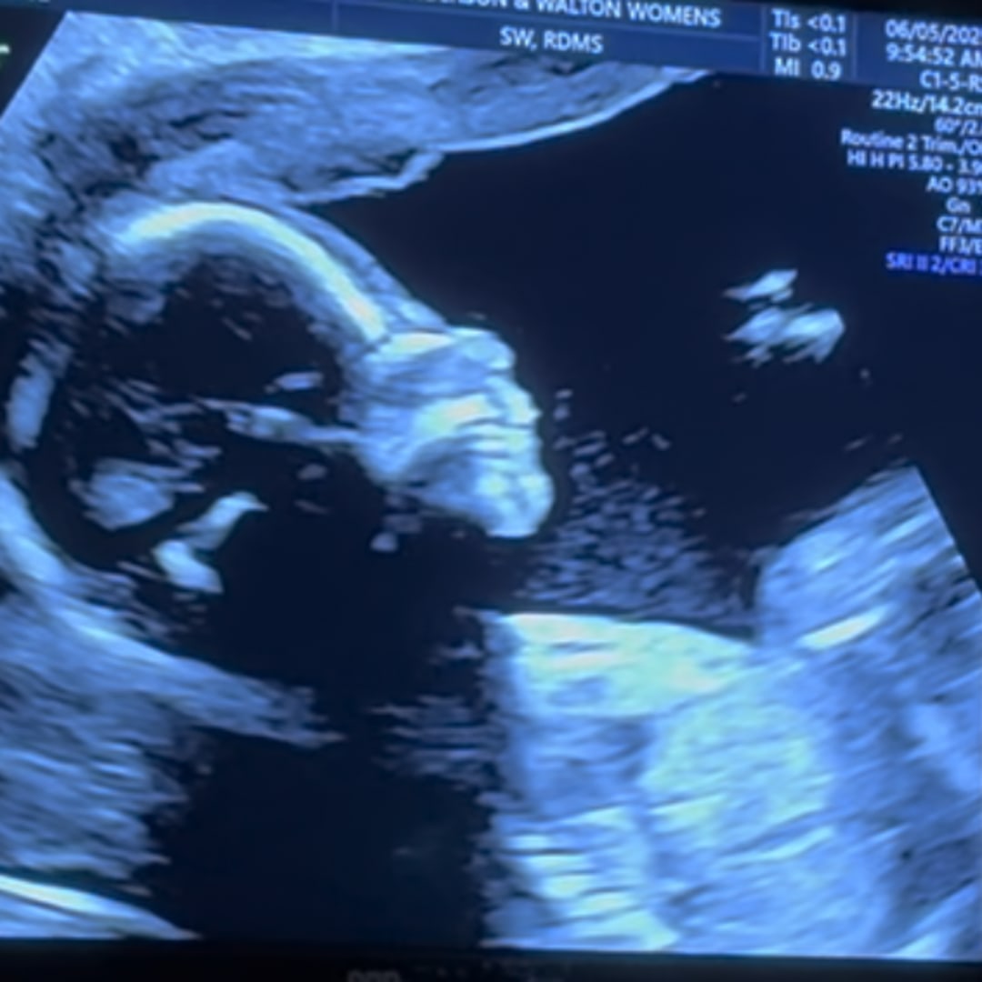 Photo shared by Elizabeth for their Babylist baby registry.