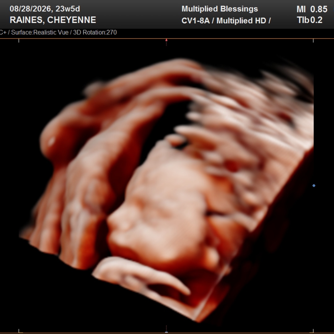 Photo shared by Cheyenne for their Babylist baby registry.