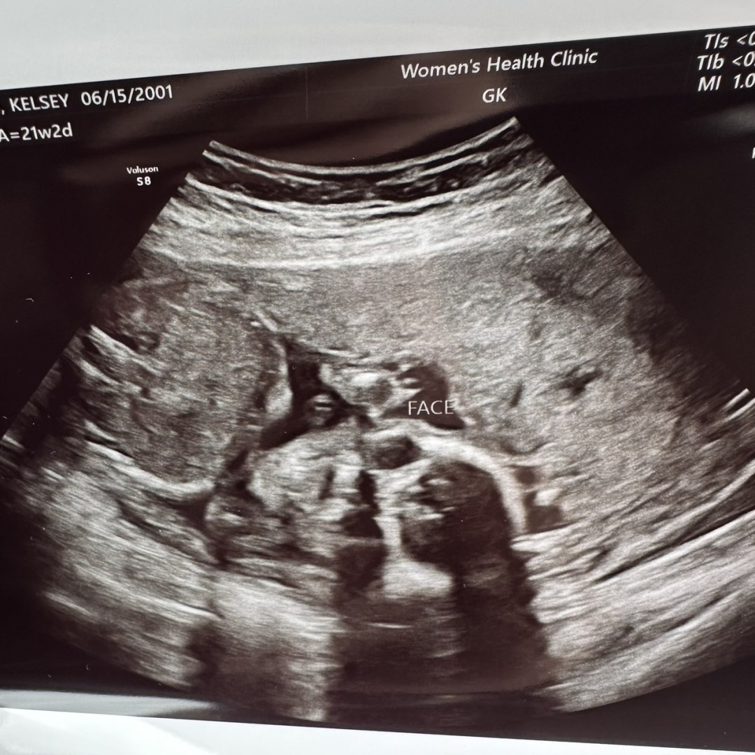 Photo shared by Kelsey for their Babylist baby registry.