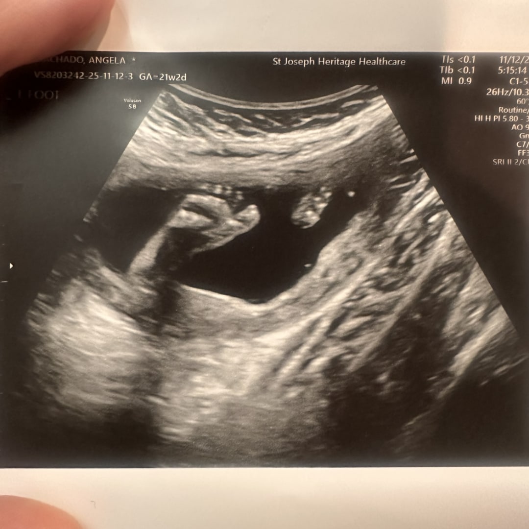 Photo shared by Angela for their Babylist baby registry.