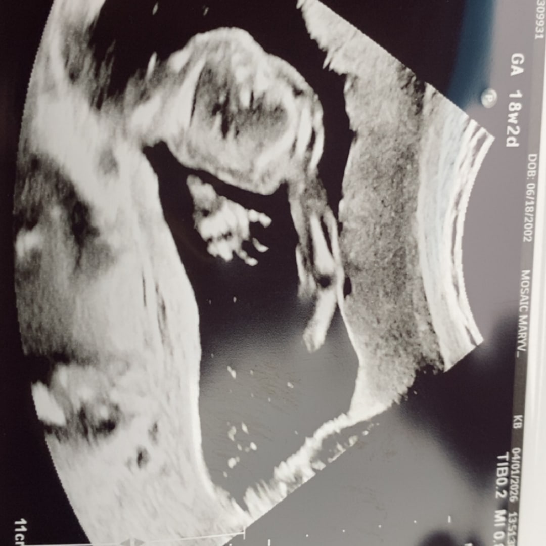 Photo shared by Chloe for their Babylist baby registry.