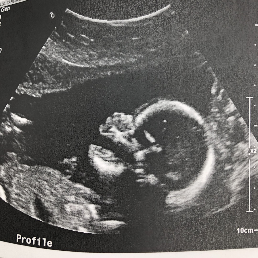 Photo shared by Candace for their Babylist baby registry.
