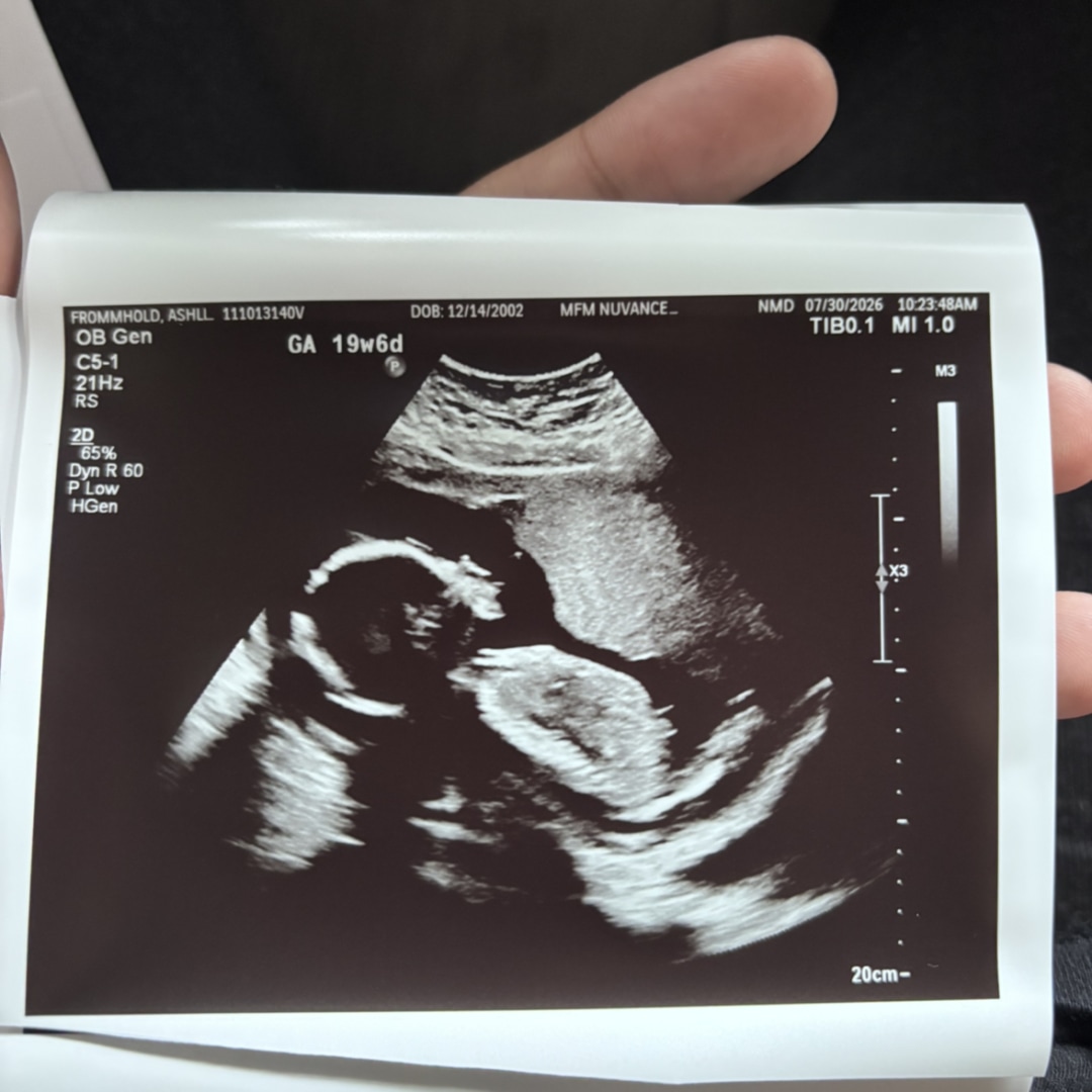 Photo shared by Ashley for their Babylist baby registry.