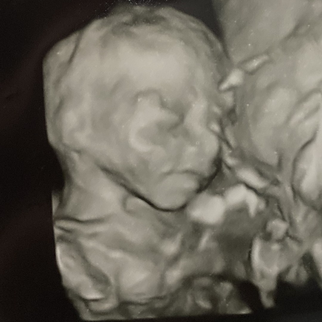 Photo shared by Alexa for their Babylist baby registry.