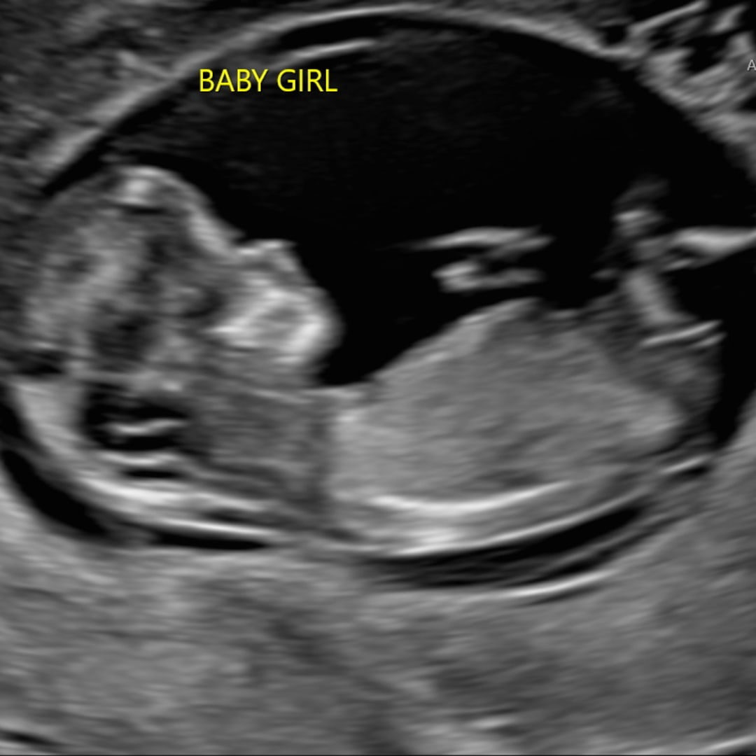 Photo shared by Cassie for their Babylist baby registry.