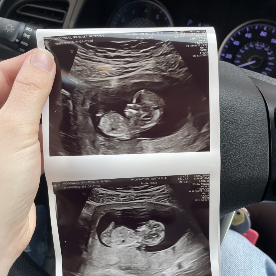 Photo shared by Franzi for their Babylist baby registry.