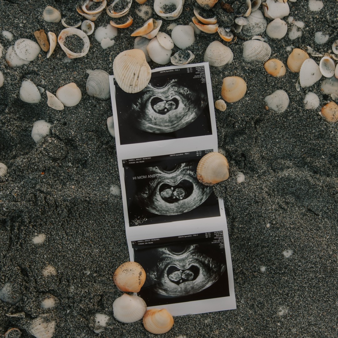 Photo shared by Ansley for their Babylist baby registry.