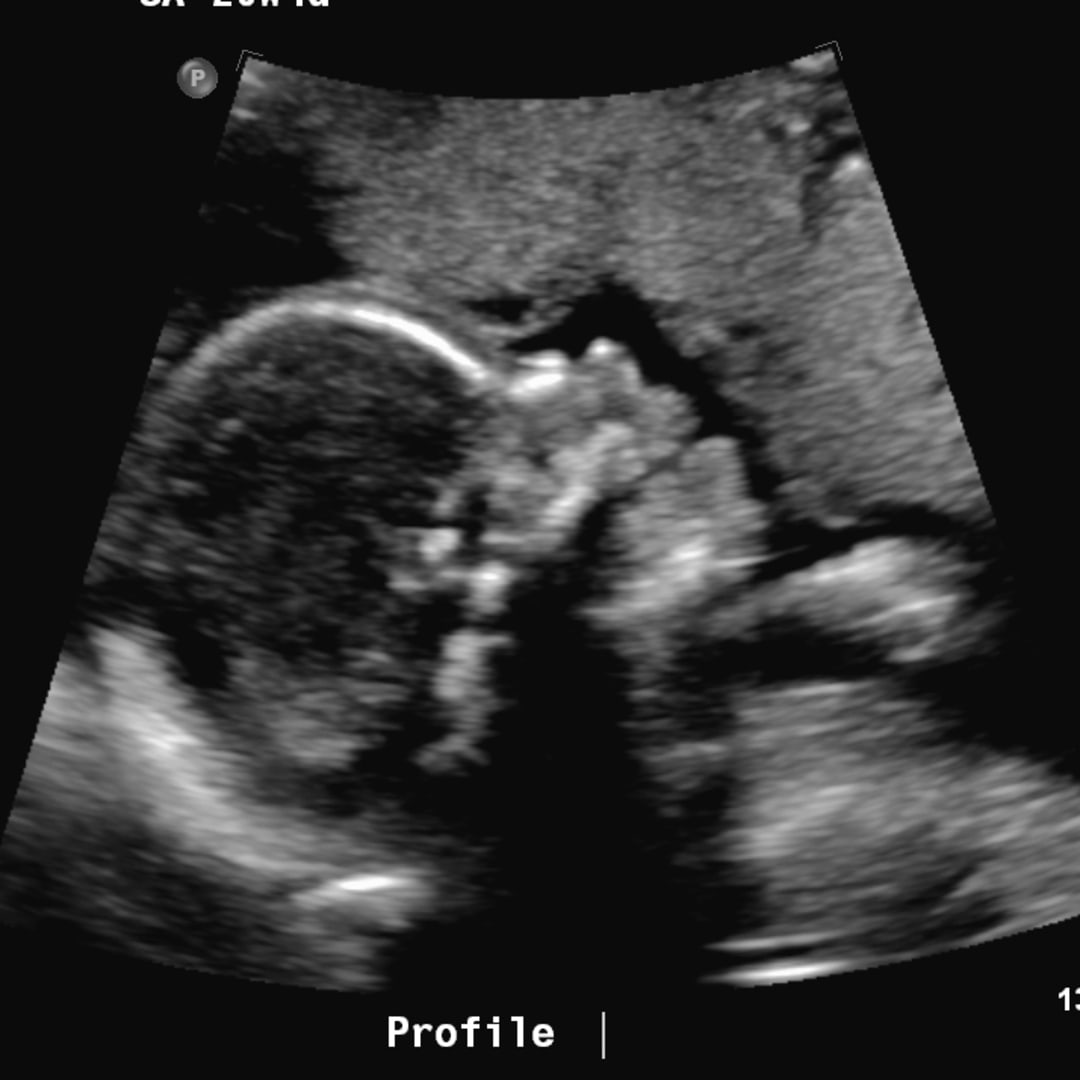 Photo shared by Mallory for their Babylist baby registry.