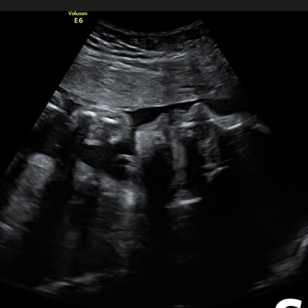 Photo shared by Lashay for their Babylist baby registry.