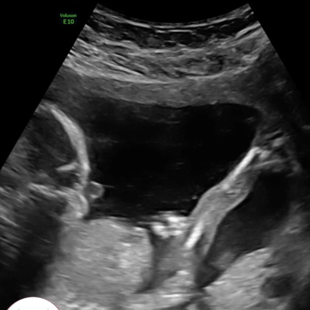 Photo shared by Allie for their Babylist baby registry.