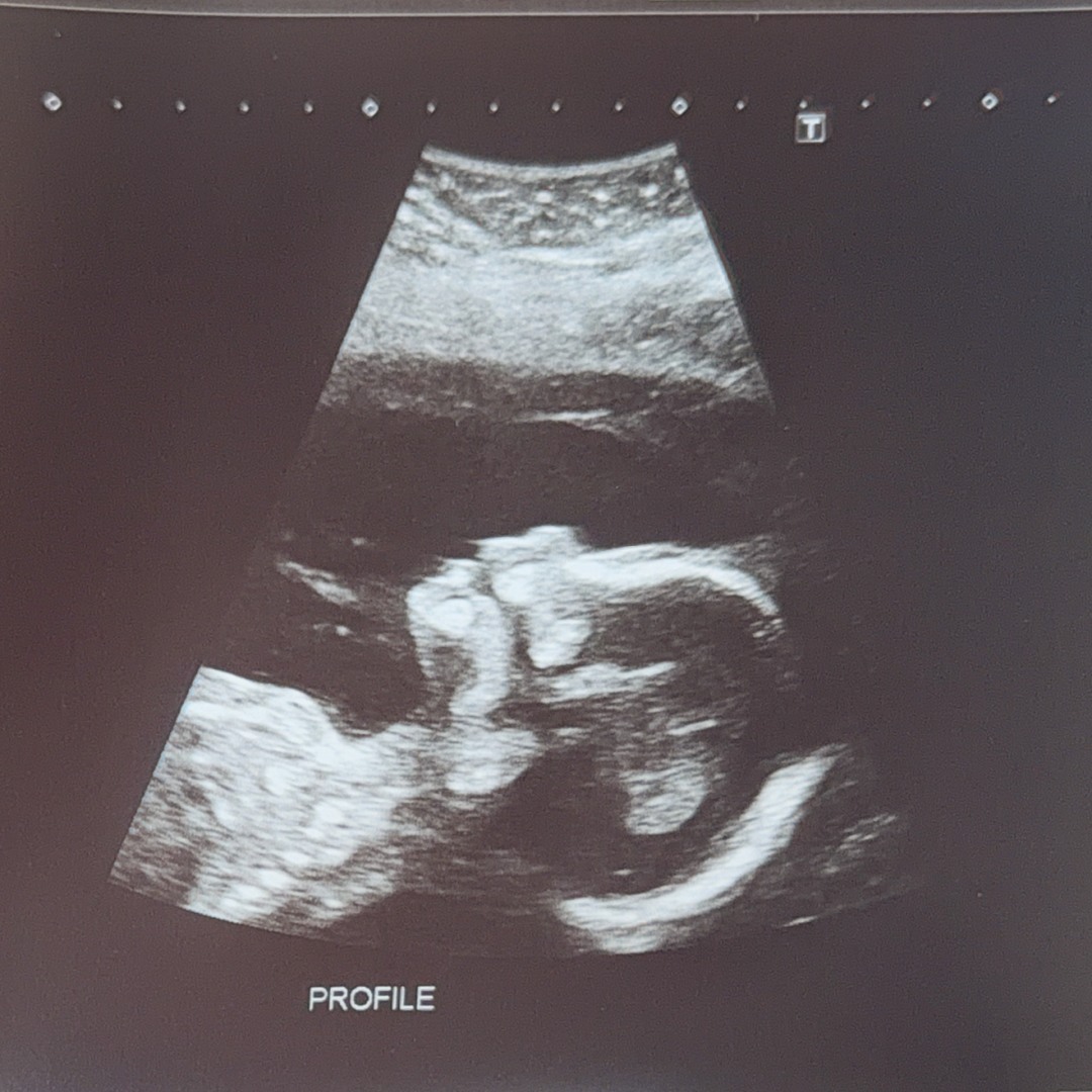 Photo shared by Alyssa for their Babylist baby registry.
