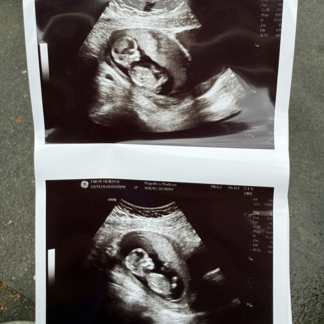 Photo shared by Maddy for their Babylist baby registry.