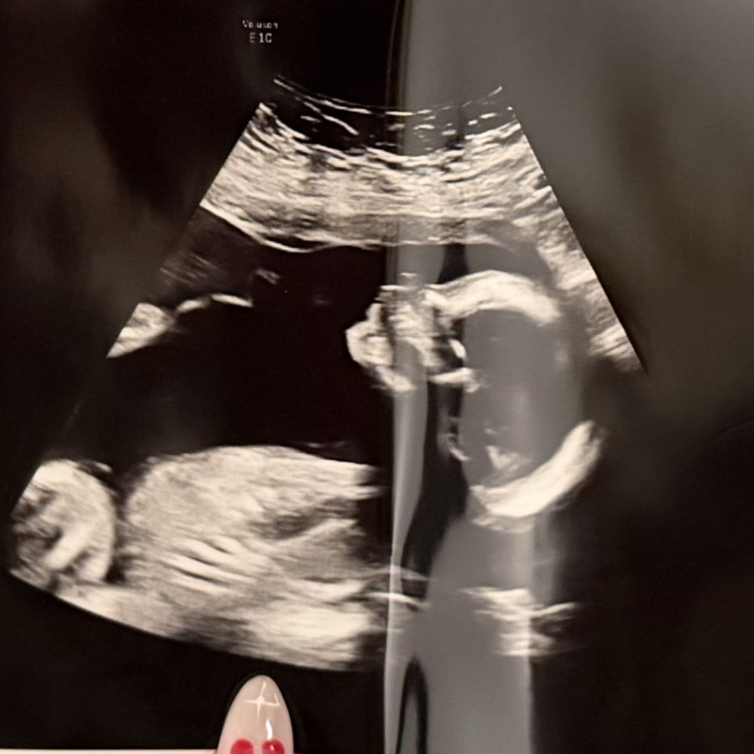 Photo shared by Danielle for their Babylist baby registry.