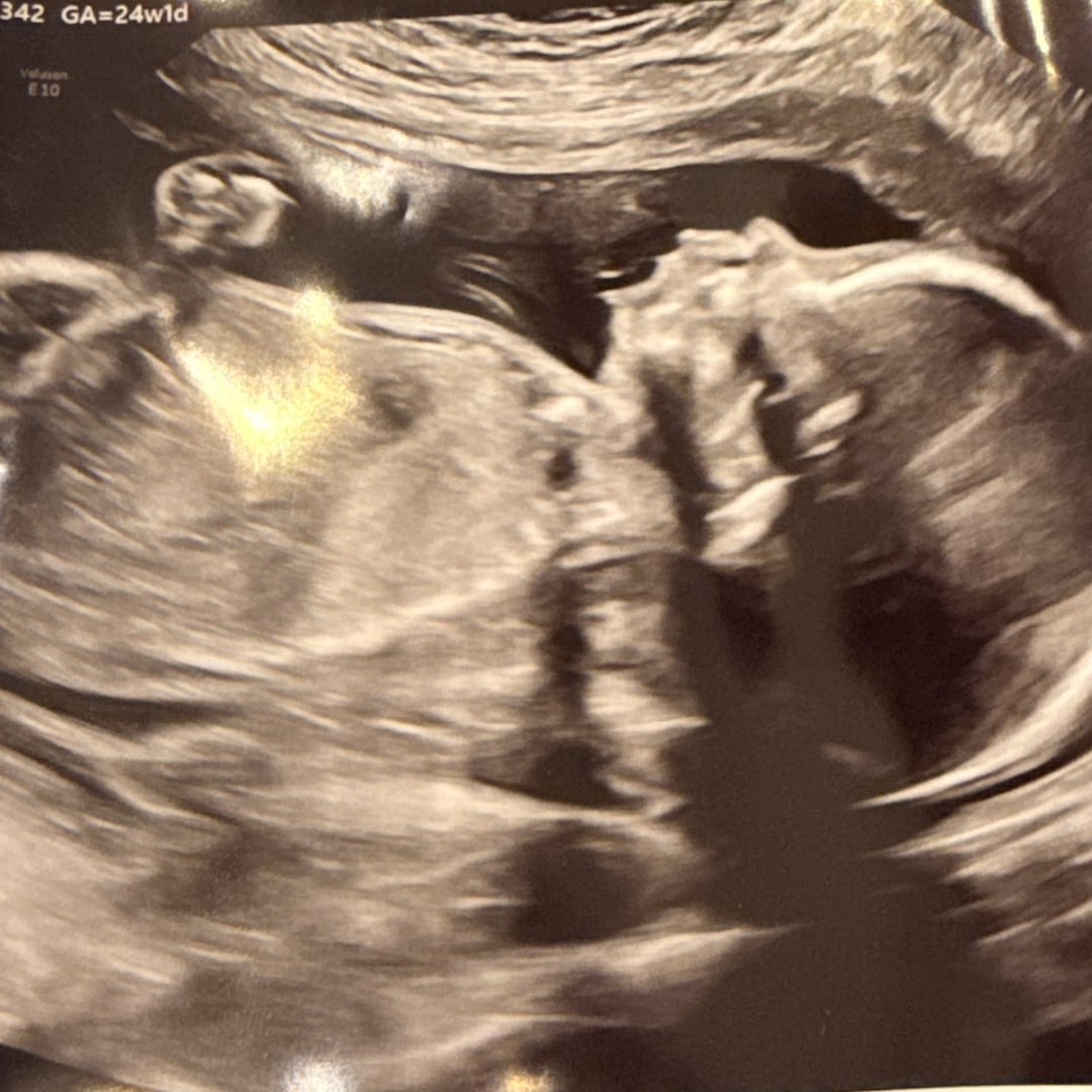 Photo shared by Emma for their Babylist baby registry.
