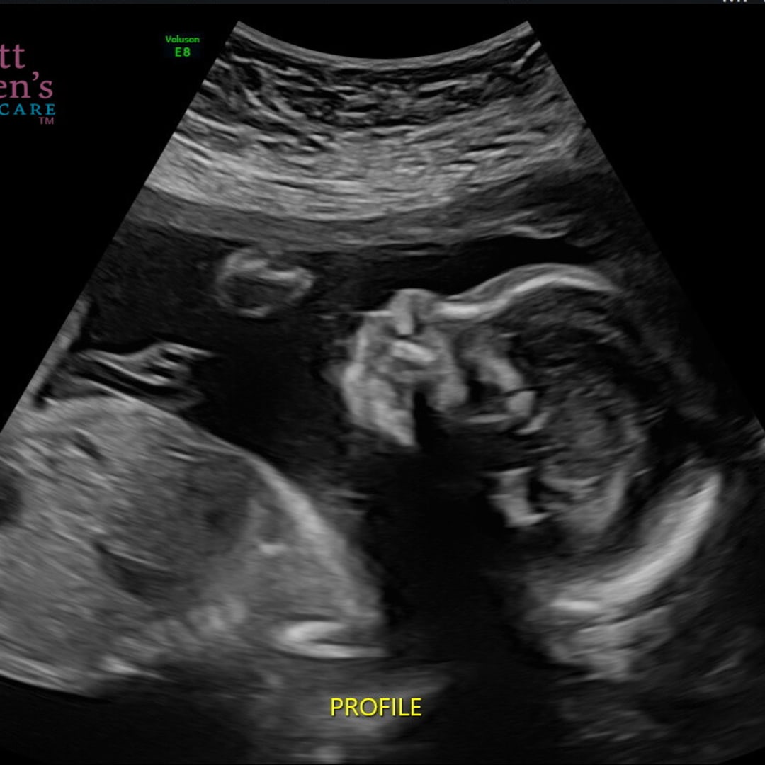 Photo shared by Jessie for their Babylist baby registry.