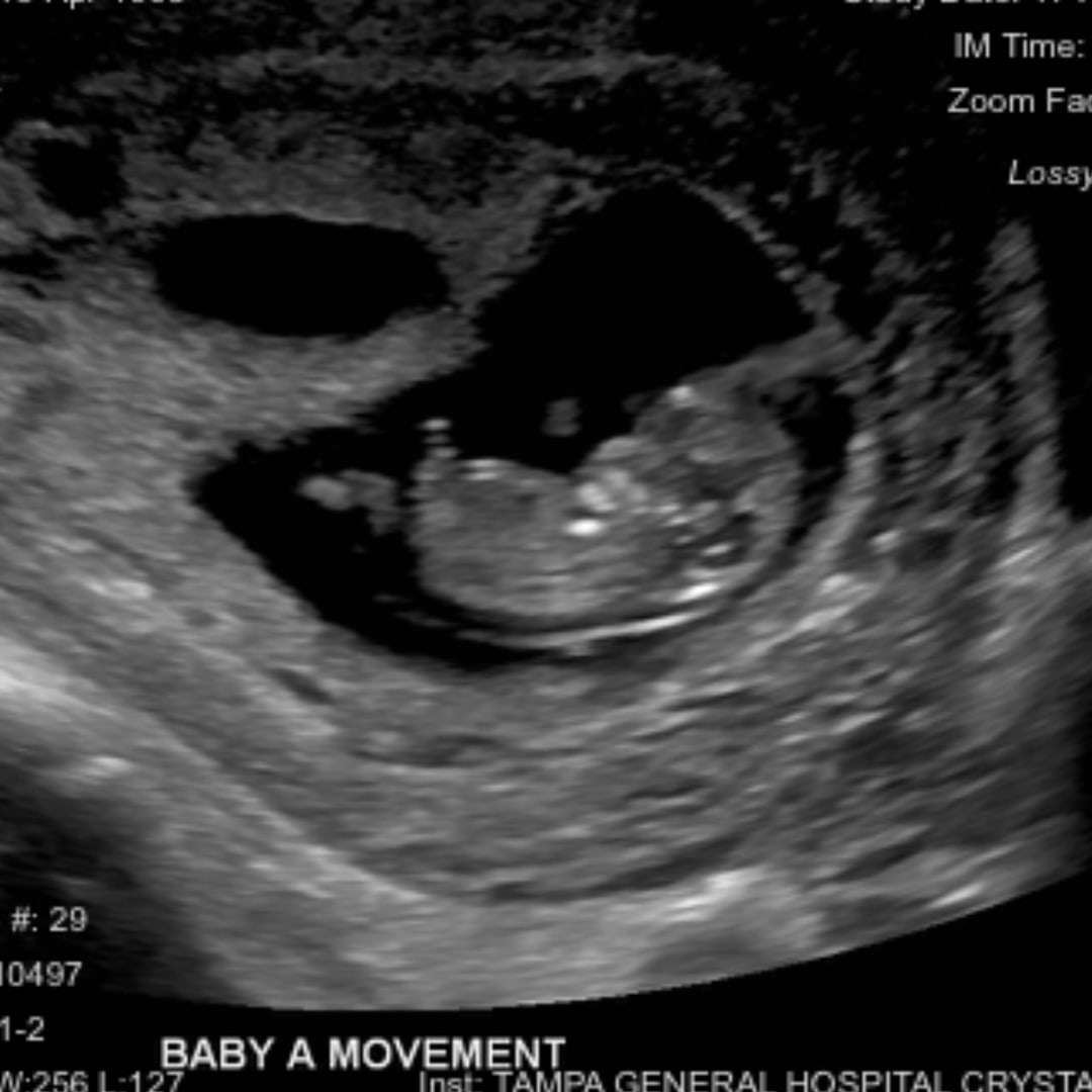 Photo shared by Jasmine for their Babylist baby registry.